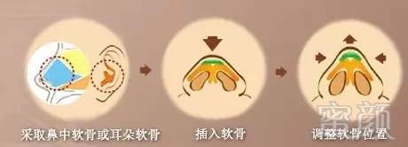 https://img.miyanlife.com/mnt/timg/170911/105IGS3-2.jpg