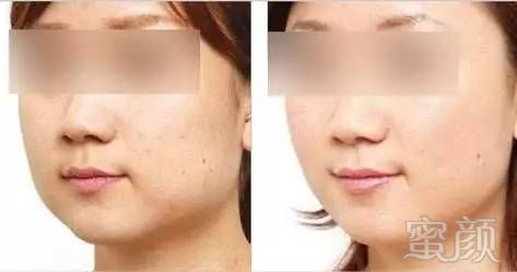 https://img.miyanlife.com/mnt/timg/170912/110K21U0-16.jpg