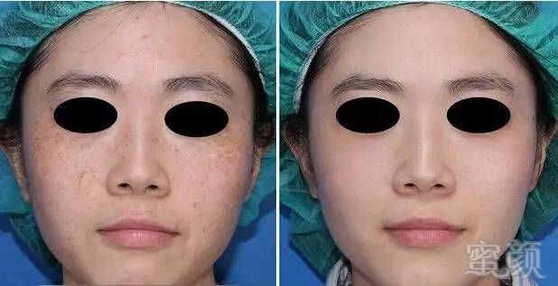 https://img.miyanlife.com/mnt/timg/170912/110K32339-20.jpg