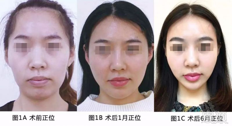 https://img.miyanlife.com/mnt/timg/170912/1111012G5-1.jpg