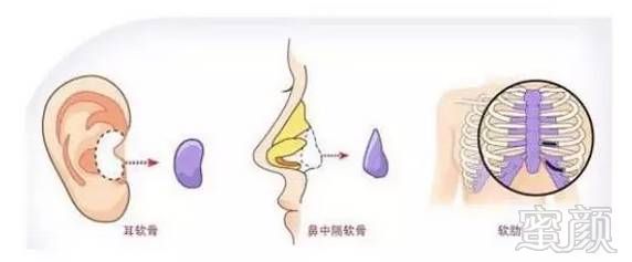 https://img.miyanlife.com/mnt/timg/170912/123235I64-10.jpg
