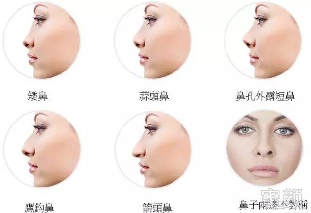 https://img.miyanlife.com/mnt/timg/170913/102P92L9-0.jpg