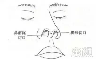 https://img.miyanlife.com/mnt/timg/170913/102Q01239-3.jpg