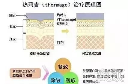 案例图片