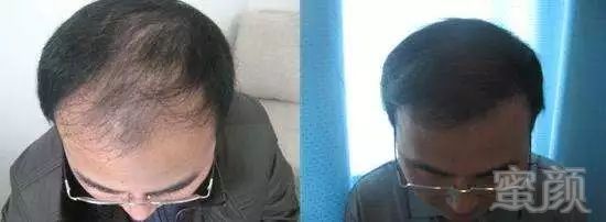 https://img.miyanlife.com/mnt/timg/170913/130U254Z-0.jpg