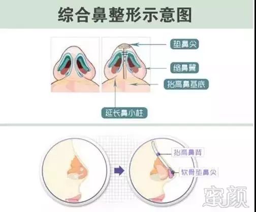 案例图片