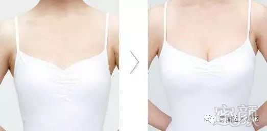 https://img.miyanlife.com/mnt/timg/170914/11191AW3-4.jpg