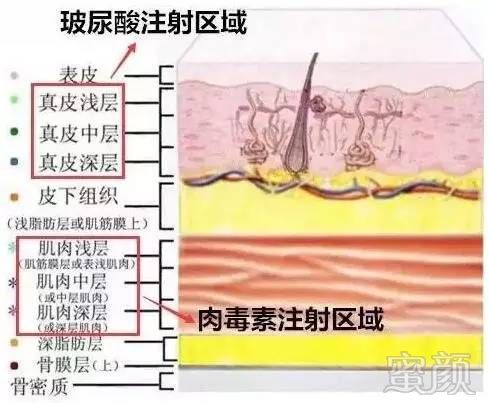 案例图片