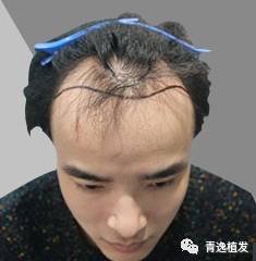 https://img.miyanlife.com/mnt/timg/170915/1121022N0-0.jpg