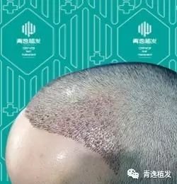 https://img.miyanlife.com/mnt/timg/170915/112102GL-1.jpg