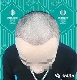 https://img.miyanlife.com/mnt/timg/170915/11210310O-3.jpg