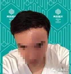 https://img.miyanlife.com/mnt/timg/170915/11210315X-5.jpg