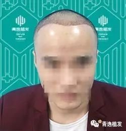 https://img.miyanlife.com/mnt/timg/170915/112103DB-2.jpg