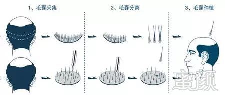 https://img.miyanlife.com/mnt/timg/170915/1126115423-2.jpg