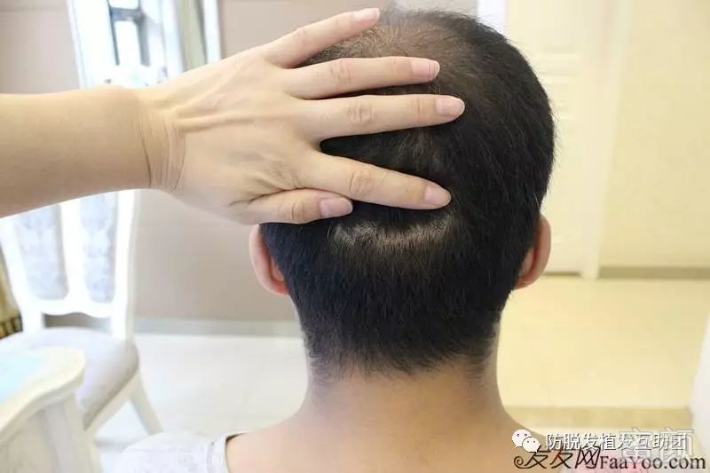 https://img.miyanlife.com/mnt/timg/170915/112H53W2-5.jpg