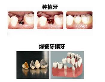 https://img.miyanlife.com/mnt/timg/170916/2053301M4-0.jpg
