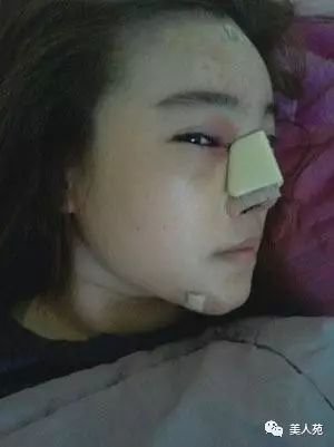 https://img.miyanlife.com/mnt/timg/170916/2101035054-3.jpg