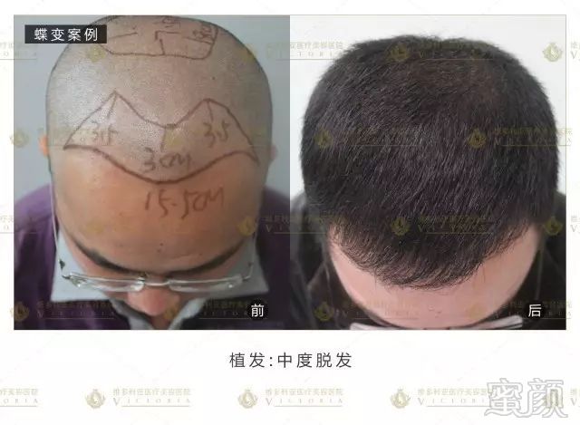 https://img.miyanlife.com/mnt/timg/170917/1439392596-9.jpg