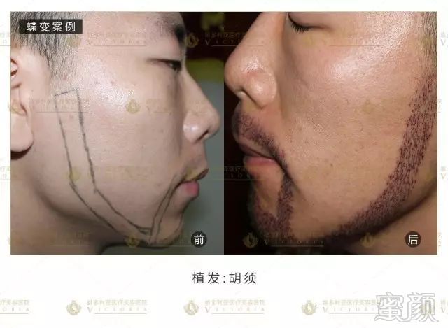 https://img.miyanlife.com/mnt/timg/170917/14393U950-8.jpg