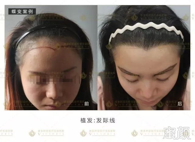 https://img.miyanlife.com/mnt/timg/170917/1439411639-14.jpg