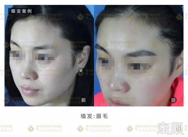 https://img.miyanlife.com/mnt/timg/170917/1439412395-15.jpg