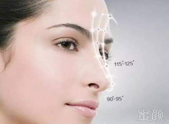 https://img.miyanlife.com/mnt/timg/170917/201T43435-3.jpg