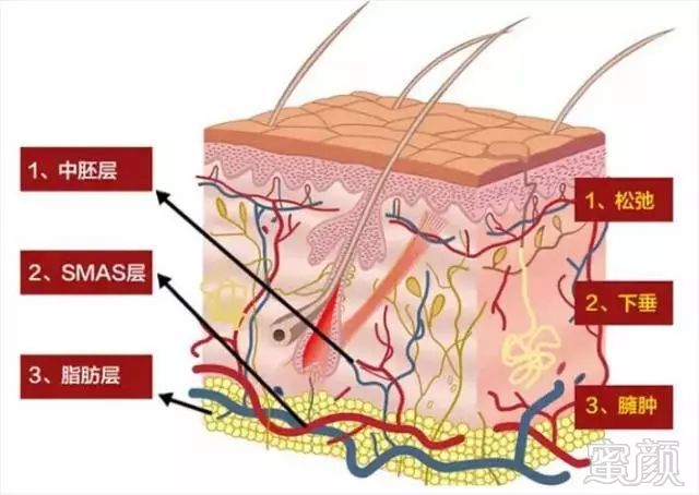 https://img.miyanlife.com/mnt/timg/170919/0949593Y7-5.jpg