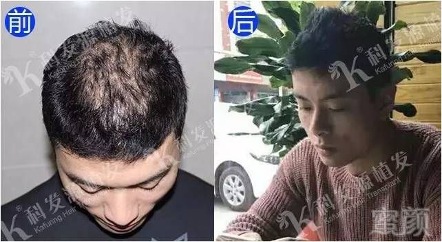 https://img.miyanlife.com/mnt/timg/170920/133G5M08-3.jpg