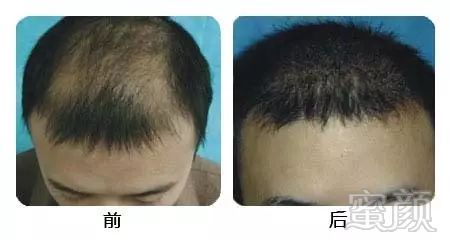 https://img.miyanlife.com/mnt/timg/170920/1405194517-3.jpg