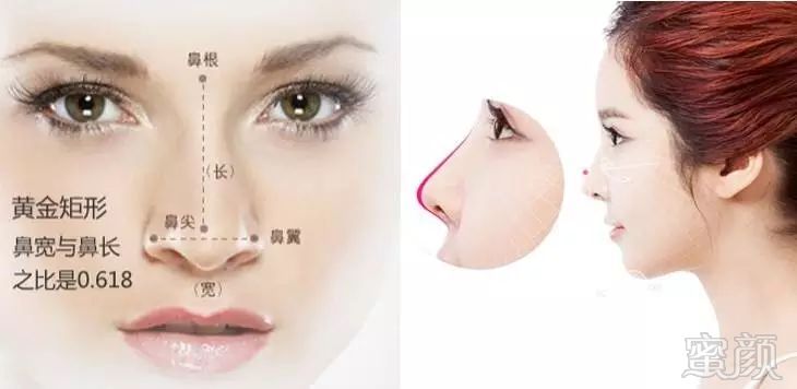 https://img.miyanlife.com/mnt/timg/170920/14245BU9-7.jpg