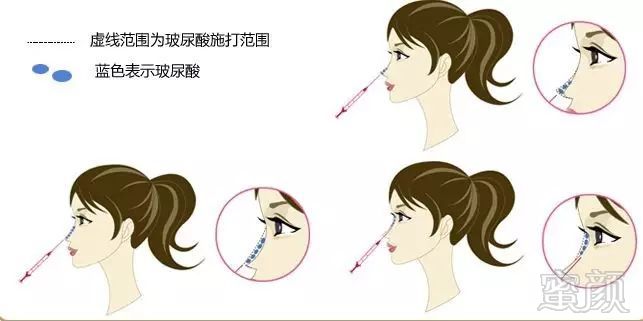 https://img.miyanlife.com/mnt/timg/170920/14245J0J-9.jpg