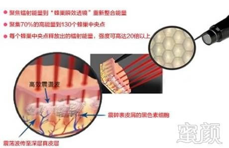 案例图片