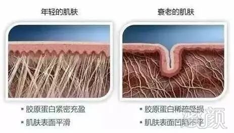 案例图片