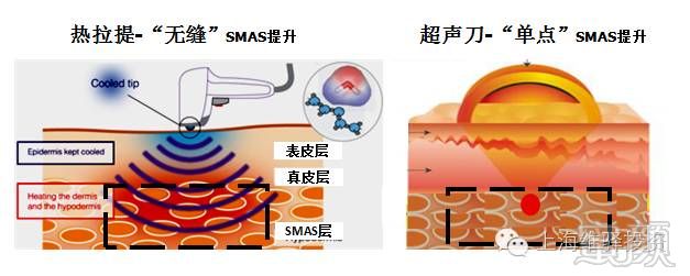 案例图片