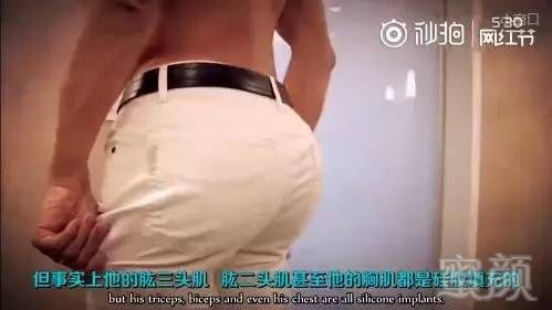 案例图片