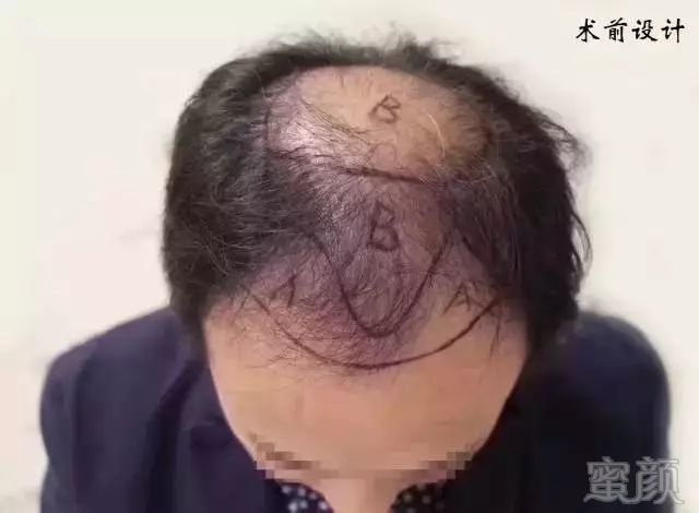https://img.miyanlife.com/mnt/timg/170921/124SH5S-10.jpg