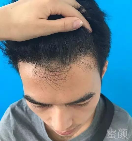 https://img.miyanlife.com/mnt/timg/170921/124SKB6-9.jpg