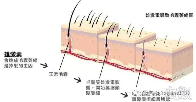 案例图片