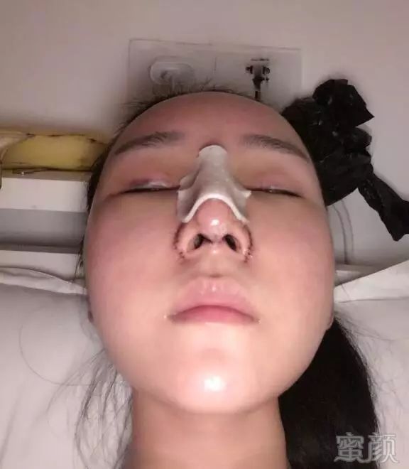 https://img.miyanlife.com/mnt/timg/170922/11192154b-3.jpg