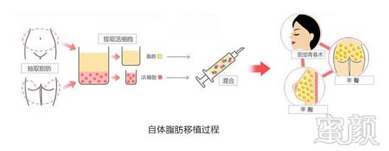 案例图片