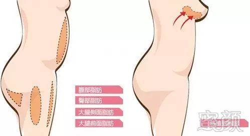 https://img.miyanlife.com/mnt/timg/170923/1934001042-1.jpg