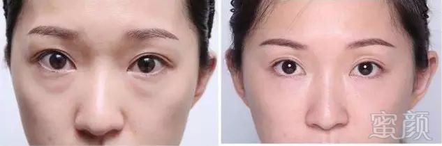 https://img.miyanlife.com/mnt/timg/170923/193401MA-4.jpg