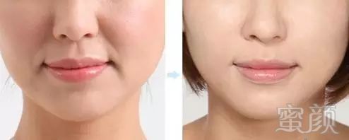 https://img.miyanlife.com/mnt/timg/170923/193402AH-5.jpg