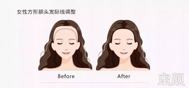https://img.miyanlife.com/mnt/timg/170923/2051543463-10.jpg
