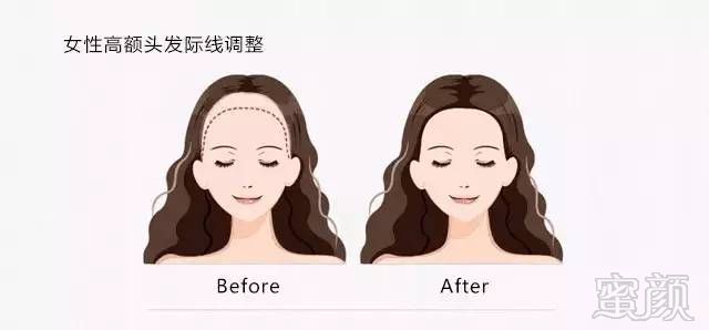 https://img.miyanlife.com/mnt/timg/170923/20515441V-9.jpg