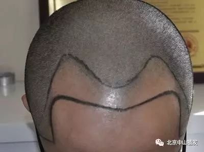 https://img.miyanlife.com/mnt/timg/170924/1529464057-2.jpg