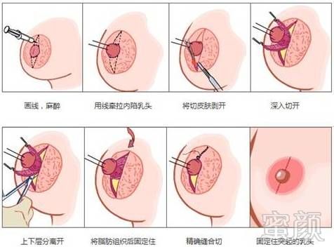 案例图片