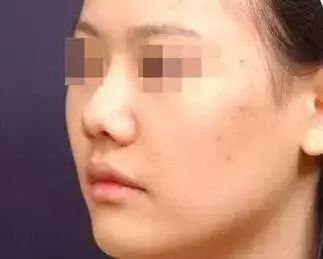 https://img.miyanlife.com/mnt/timg/170925/111K135Y-4.jpg