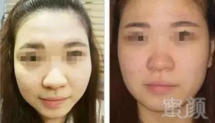https://img.miyanlife.com/mnt/timg/170925/111K13614-3.jpg