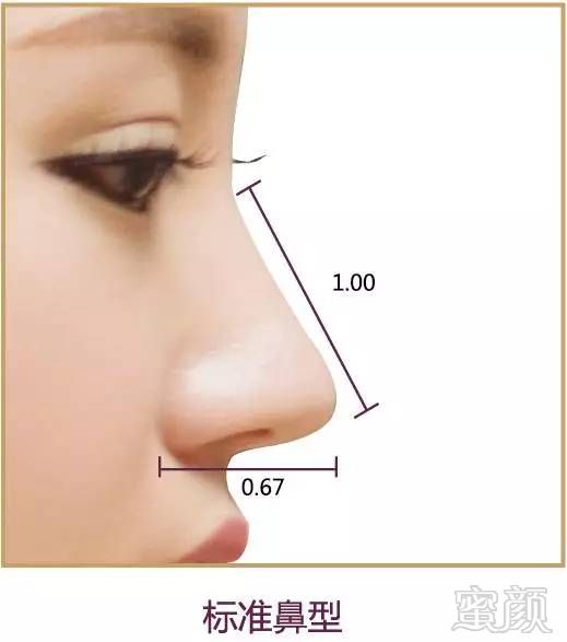 https://img.miyanlife.com/mnt/timg/170925/111K14047-6.jpg